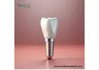 Meet Dental Implant Manufacturers in Peru Focused on Quality