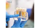 Dental Implant Kits Nicaragua for Efficient Procedures