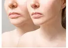 Top 5 Combination Treatments for Total Facial Rejuvenation