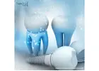 Trusted Best Dental Implant Manufacturers In Honduras 2025